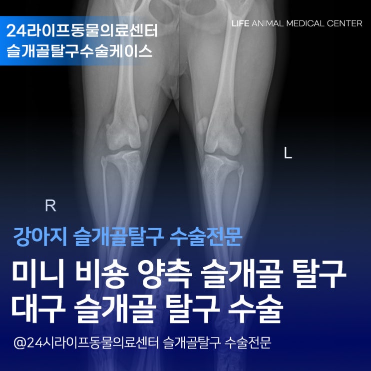 미니 비숑 양측 슬개골 탈구 수술 : 대구슬개골탈구수술 동물병원