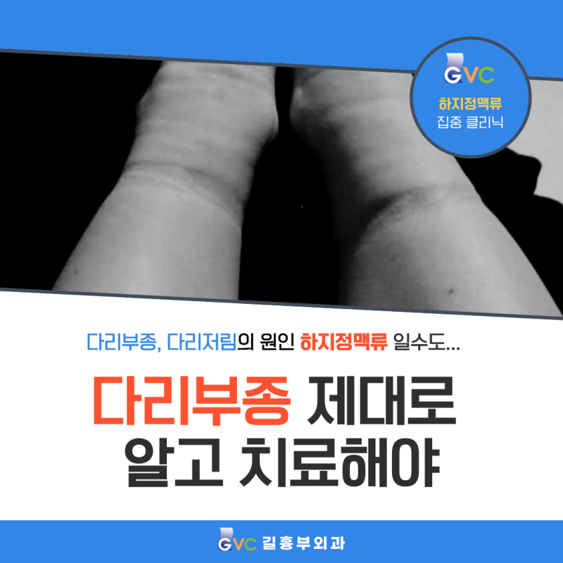 김해하지정맥류 다리부종 제대로 알고 치료해야