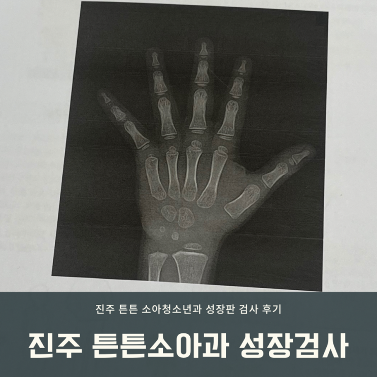  진주 성장판 검사) 튼튼 소아청소년과에서 5살 아이 성장 검사한 후기