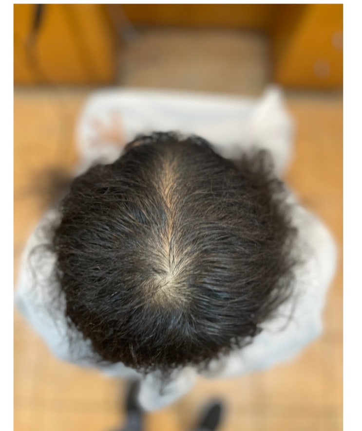  남자탈모펌 입금전 입금후 부산경남 사상르네시떼6층탈모커버복구클리닉전문 미용실