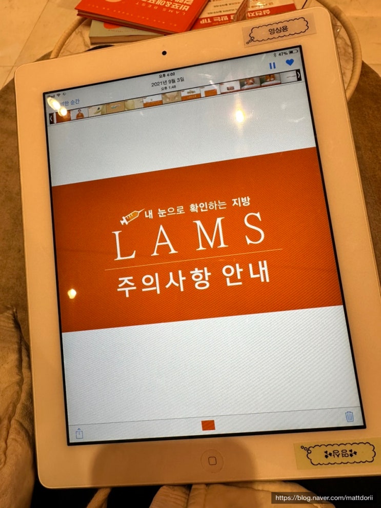 복부 일반<b>람스</b> 시술당일 후기(시술시간, 주의사항 등)