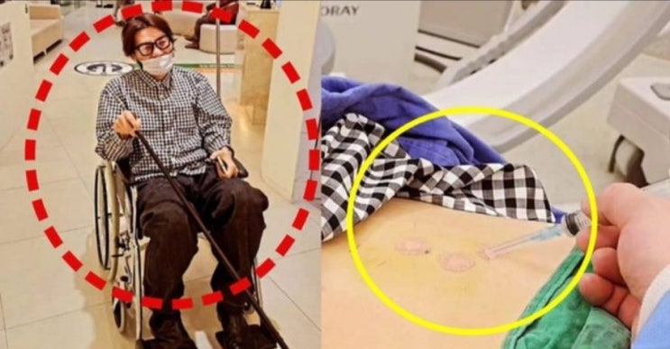 <연예가핫이슈> 응급 수술 들어간 노홍철... 충격적인 건강 상태 전해졌다 <연예가핫이슈> 응급 수술 들어간 노홍철... 충격적인 건강 상태 전해졌다