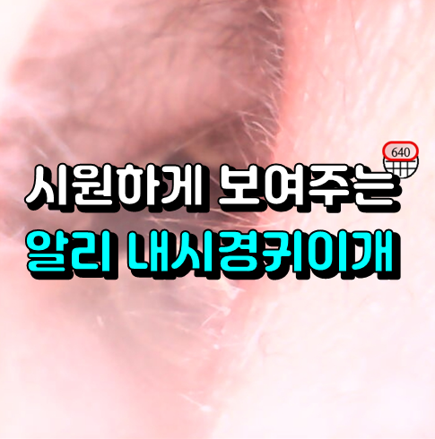 불쾌감 주의 알리 내시경귀이개 알리내시경귀이개 어플