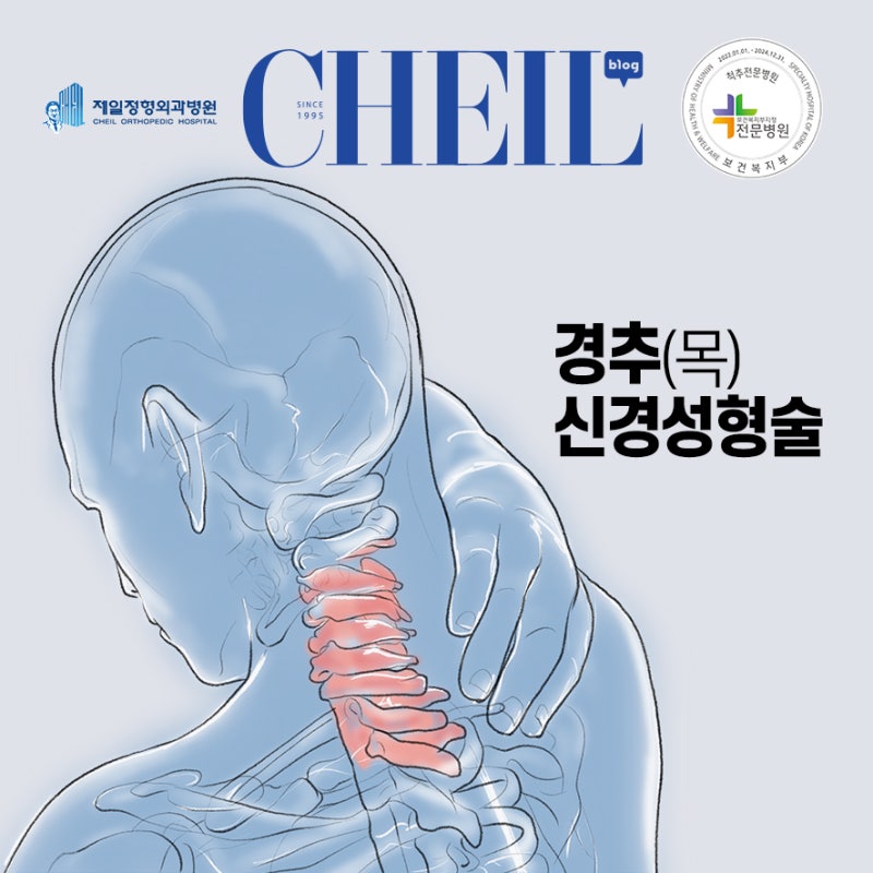 경추 질환을 치료하는 데 도움이 되는 경추 신경성형술에 대해... feat. 척추센터 김경한 원장 : 네이버 블로그