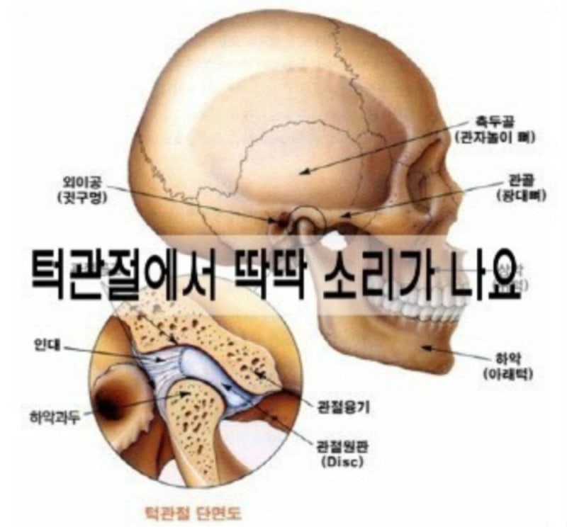 루이빈치과 신경차단술 후기(1)
