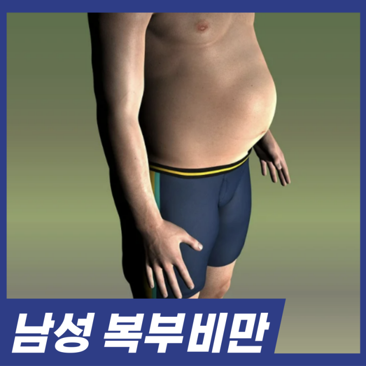  남성이 복부비만 더 많다? 중년 복부비만 위험성 관리방법