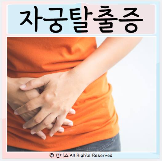  자궁탈출증 원인 증상 치료방법