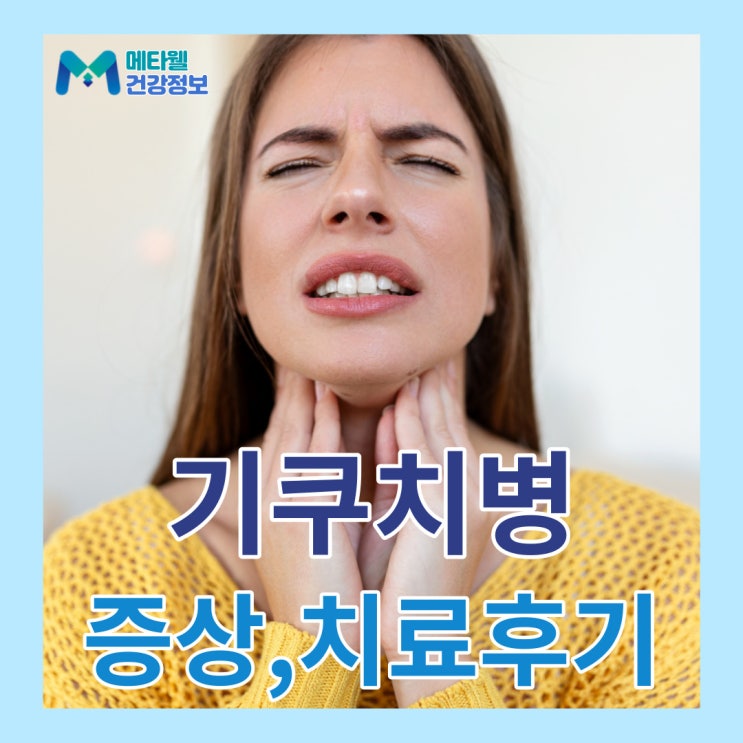  젊은 여성들이 잘 걸리는 기쿠치병, 기꾸찌병의 원인과 증상, 조직검사, 치료후기 경험담