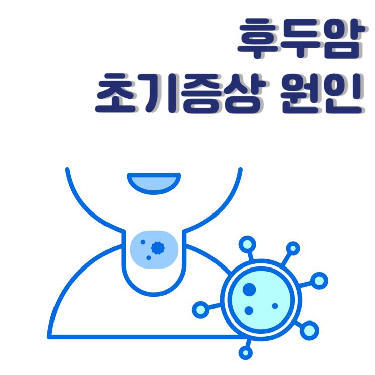  후두암초기증상 목부음 목아플때 증상이 나타난다?