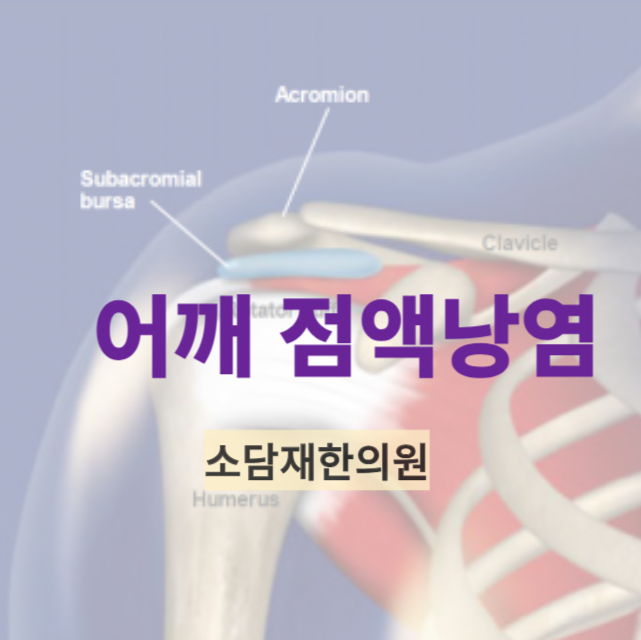 어깨점액낭염의 치료