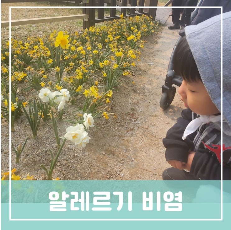 어린이 알레르기 비염 증상 예방 및 개선을 위한 건강관리 어린이 알레르기 비염 증상 예방 및 개선을 위한 건강관리
