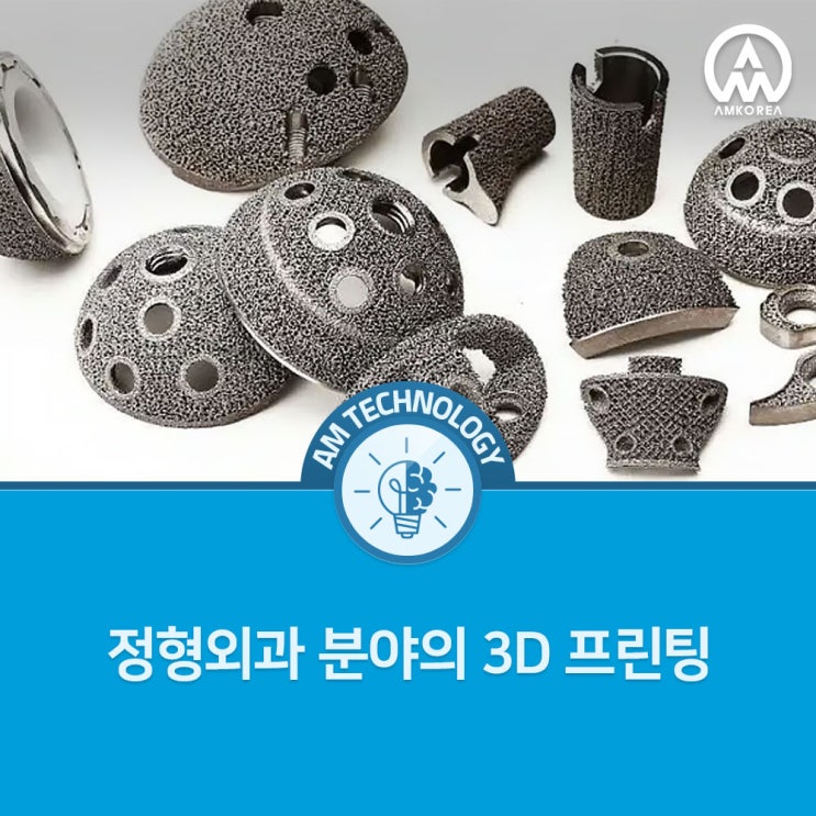 [AM 기술지식] 정형외과 분야의 3D 프린팅