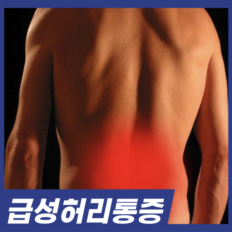  겨울철 급증하는 급성허리통증 원인 치료법