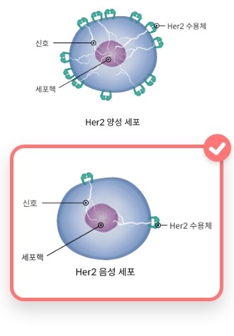  Her2 - 음성(negative)