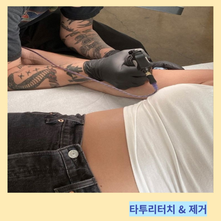 타투리터치 기간 및 문신 타투제거 비용 후기 정리