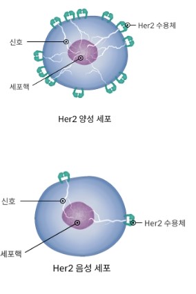  Her2 - 애매함(equivocal)