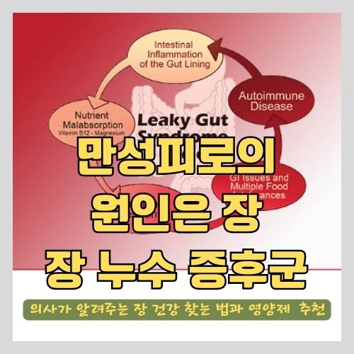  장누수증후군과 만성피로 - 장건강을 회복하는 5가지 전략과 영양제 추천 (과민성대장증후군, 염증, 면역등)