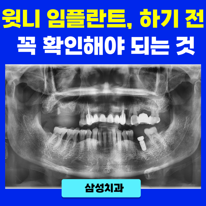 연산동치과의원 배치확인 공유