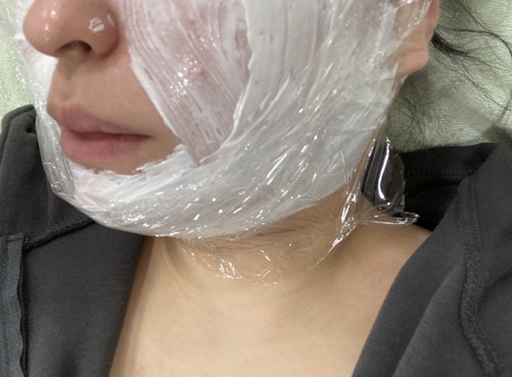  광주피부과 텐써마 처음해봤는데 찐 얼굴 작아진듯