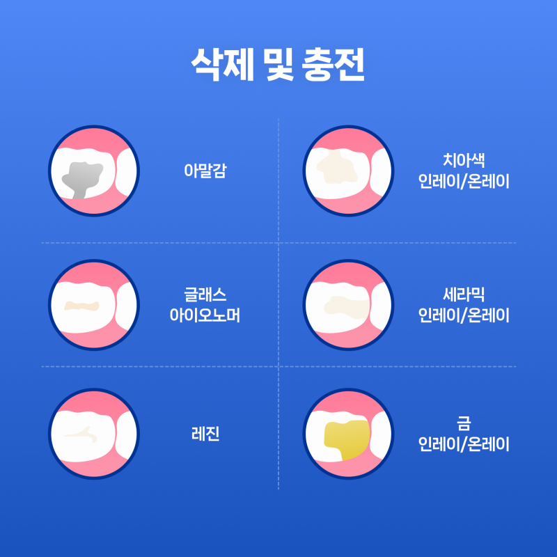 충치치료보험이 무엇인지 알아봅시다. 1