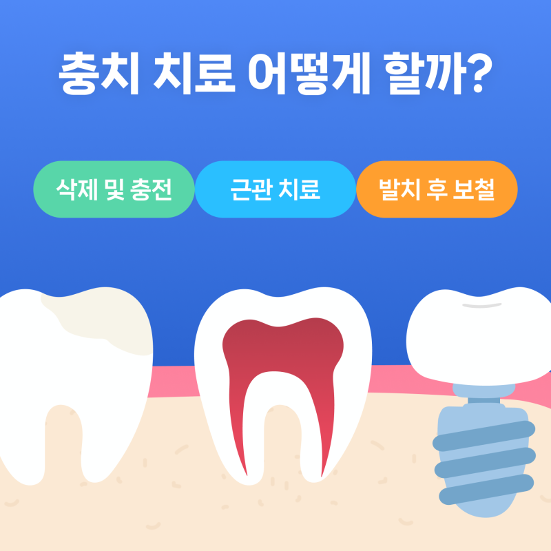 충치치료보험이 무엇인지 알아봅시다. 2