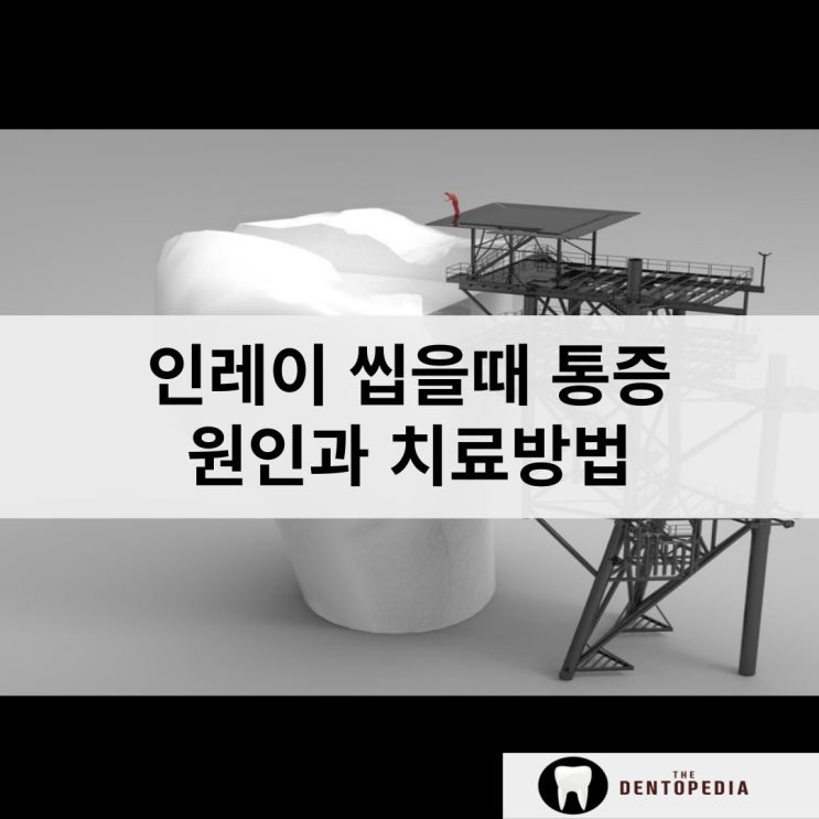  인레이씹을때통증 원인과 치료방법