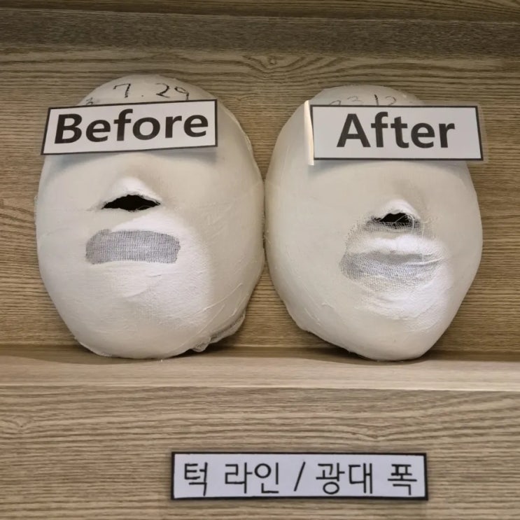  김해피부관리 약손명가 1회 효과 있을까?