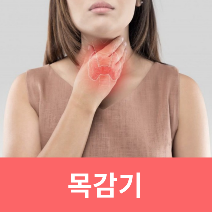  목감기 초기증상 빨리 낫는법 목감기에 좋은 차