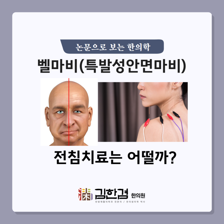 '벨마비'로 양방 치료받을 때, 추가로 전침치료를 받는다면?