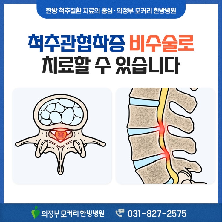  의정부척추관협착증치료방법 비수술로 해결