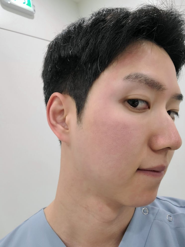  월급쟁이 의사 자기만족도 1위 시술, 레이저 남자 제모 후기, 효과, 횟수, 주기, 부작용, 통증, 고통, 세게, 약하게, 가격, 아포지 젠틀맥스 비교