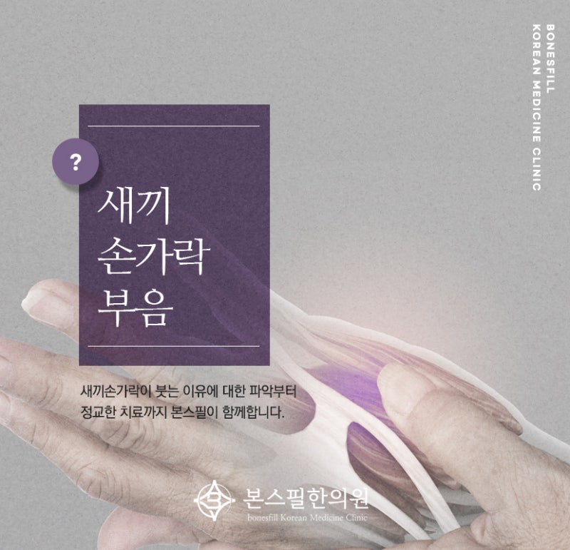 새끼손가락 부음 및 마디 통증 원인부터 관리까지