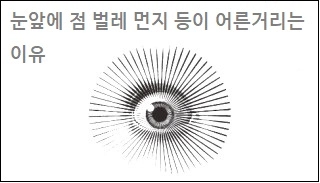  눈 앞에 점 눈앞에 벌레 먼지 등이 어른거리는 이유