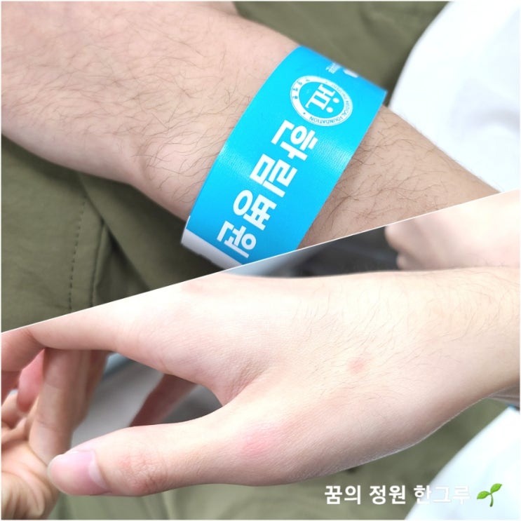  고3 스트레스 원인모를 두드러기 급성 좁쌀 두드러기 알레르기 응급실