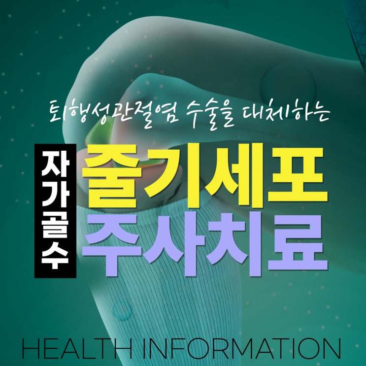  은평구 퇴행성관절염 수술을 대체하는 줄기세포주사치료?