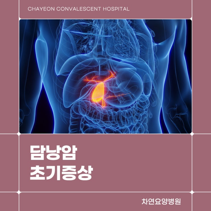  담낭암 초기증상과 발병률이 높은 위험요인