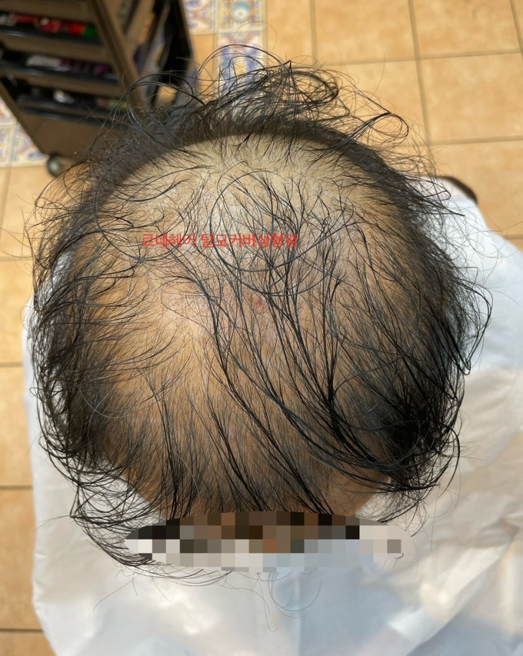  이거슨 탈모 펌 부산 남자 탈모 커버 펌 잘하는 미용실 추천 부산사상르네시떼헤어샵
