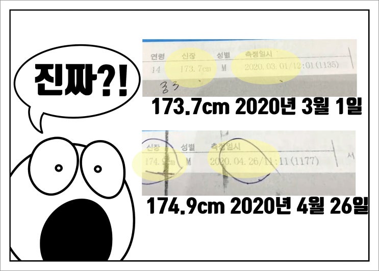  키 크는 한약, 복용할 때 안할 때의 효과 차이 비교!