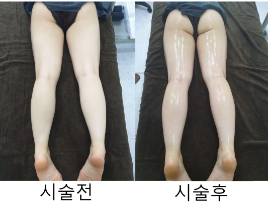  근육 탄탄 다이어트 슬리밍 마사지