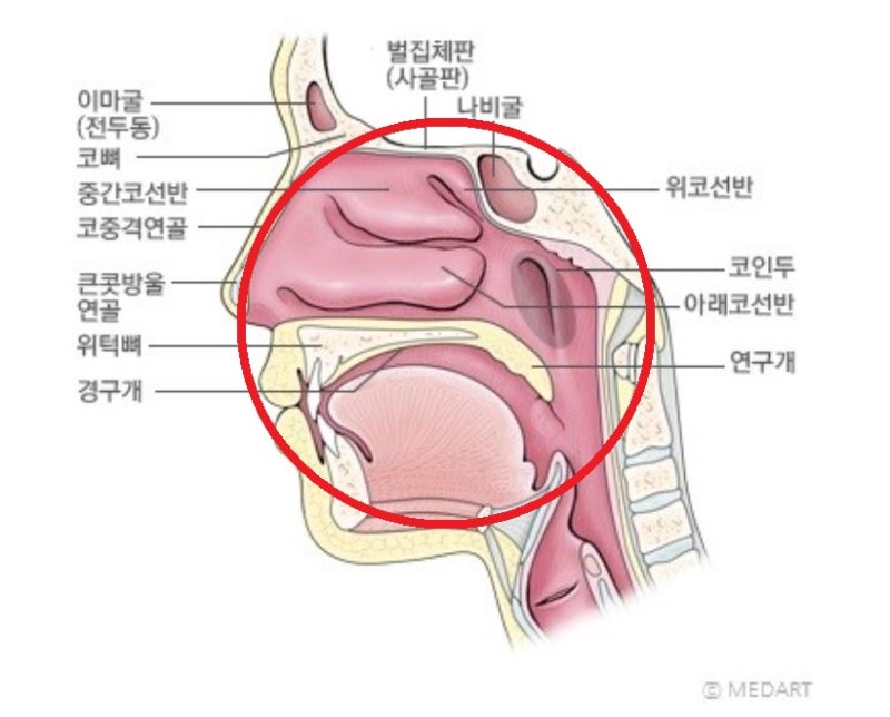 울산코골이, 코골이 원인, 비염 비만 피로, 수면 무호흡