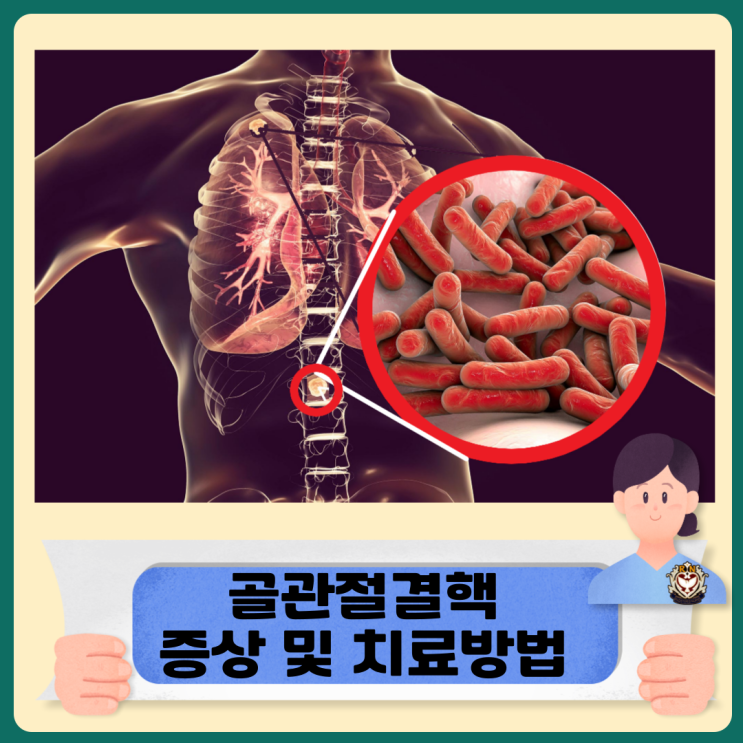  골관절결핵 증상 및 치료방법