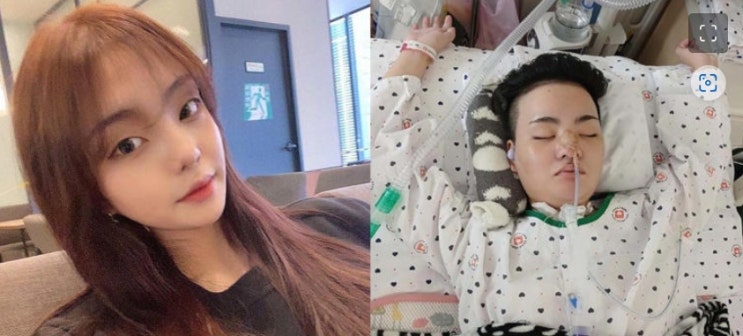  내 딸 여지연을 식물인간으로 만든 가해자의 근황…(형량높여야한다vs기회를주어야한다) 여러분의 생각은 어떠신가요?