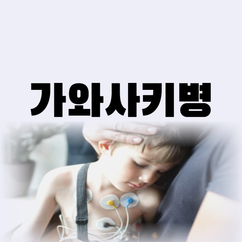 가와사키병 증상 전염 후유증 딸기혀 치료까지