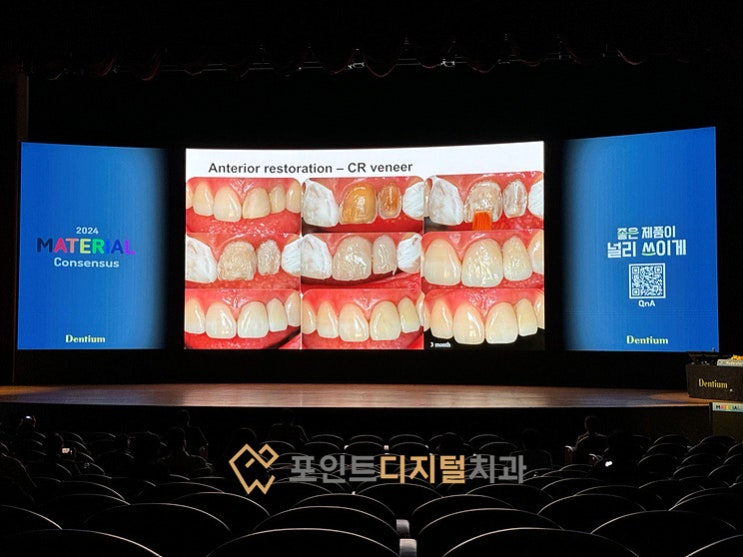  [탕정치과] 2024 Dentium Material Consensus에 다녀왔습니다.