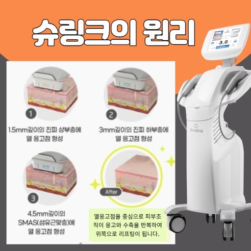  개그맨 서태훈, 박소영님 간석동 피부과 연세프리마의원 슈링크 시술