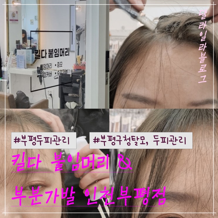  부평구청역 부평두피관리 탈모관리 킬다 붙임머리 & 부분가발 인천부평점에서 두피케어 받아 본 후기