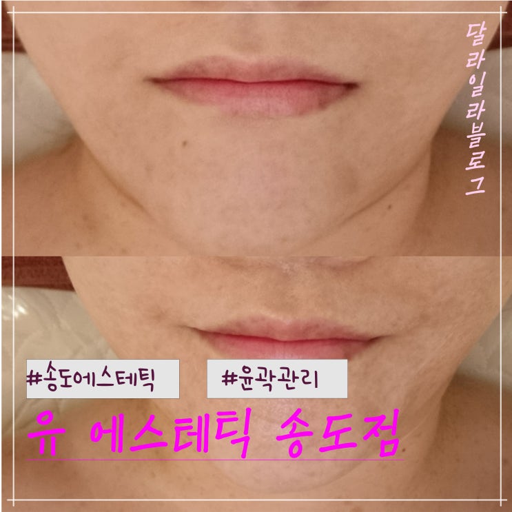  송도에스테틱 추천 유 에스테틱 송도점 윤곽관리부터 피부관리까지 잘하는 곳