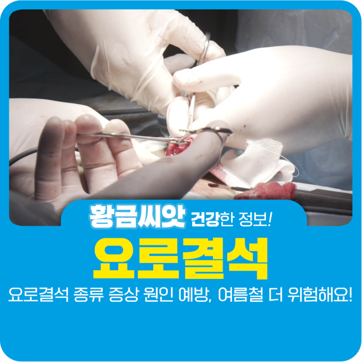  요로결석 종류 증상 원인 예방, 여름철 더 위험해요!