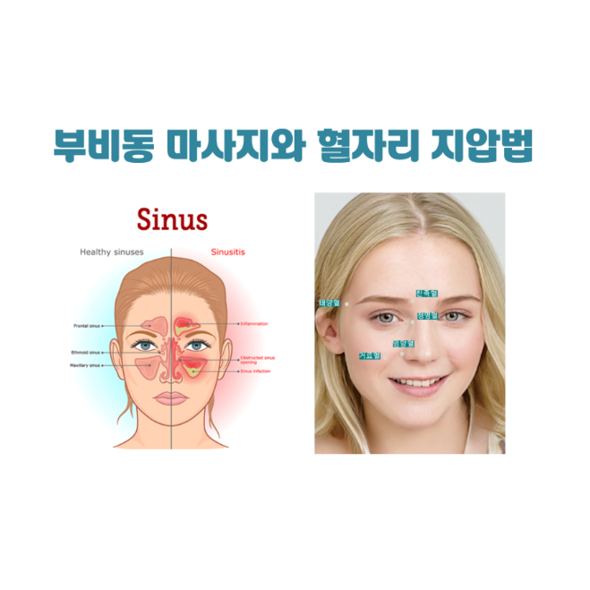 부비동 마사지, 비염에 좋은 얼굴 혈자리 지압법