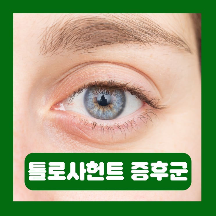  톨로사헌트 증후군 원인 증상 치료 및 관리